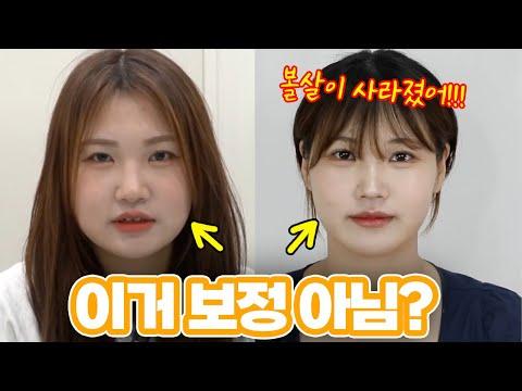 하루아침에 볼살이 사라졌어요!